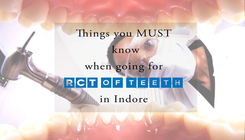 RCT of teeth in Indore-Indore-HD