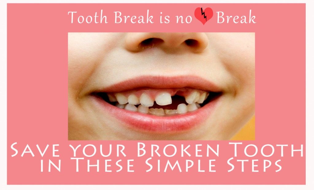 Save your Broken Tooth in These Simple Steps-Indore-HD.psd