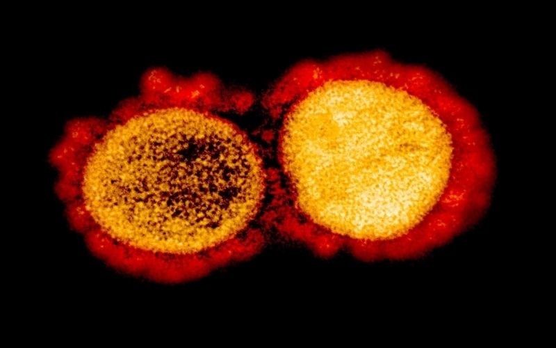 microscope view of virus